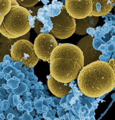 staph-aureus-bacteria-16790.jpg